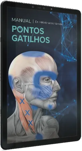 Manual de Pontos Gatilhos